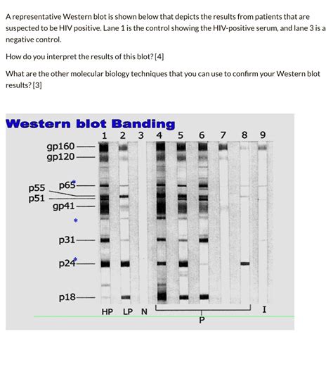 hiv elisa positive western blot negative